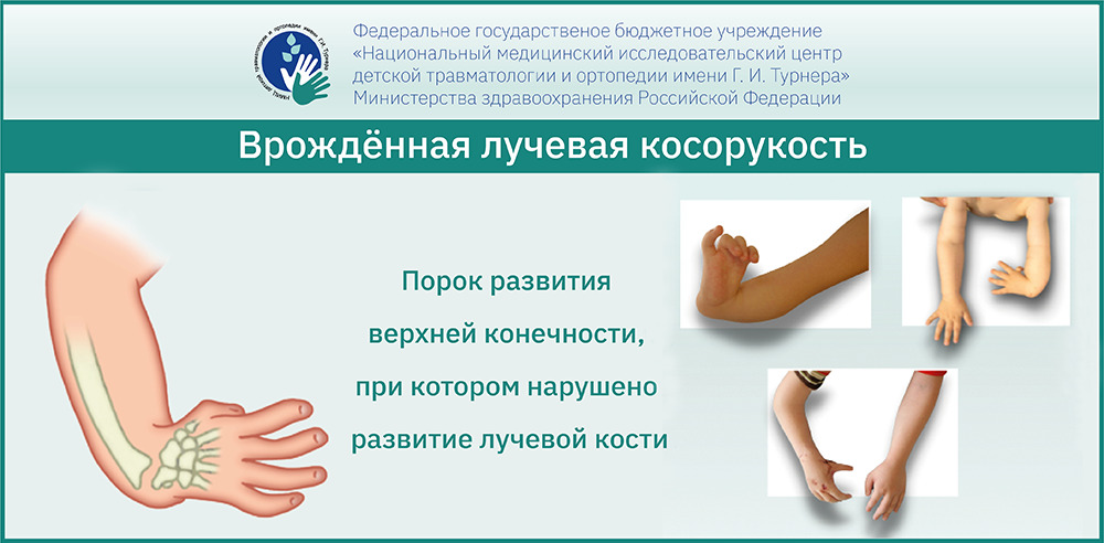 Использование специальных тестов