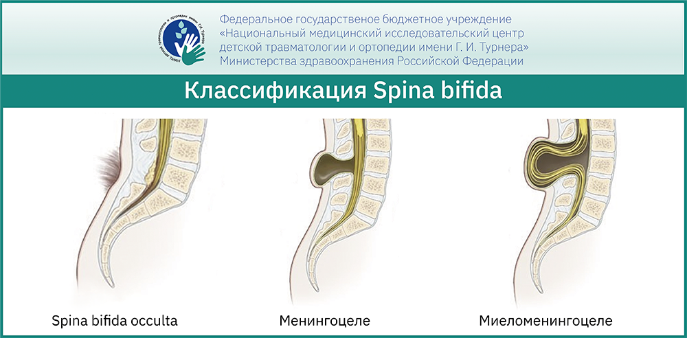 Эффективные методы лечения