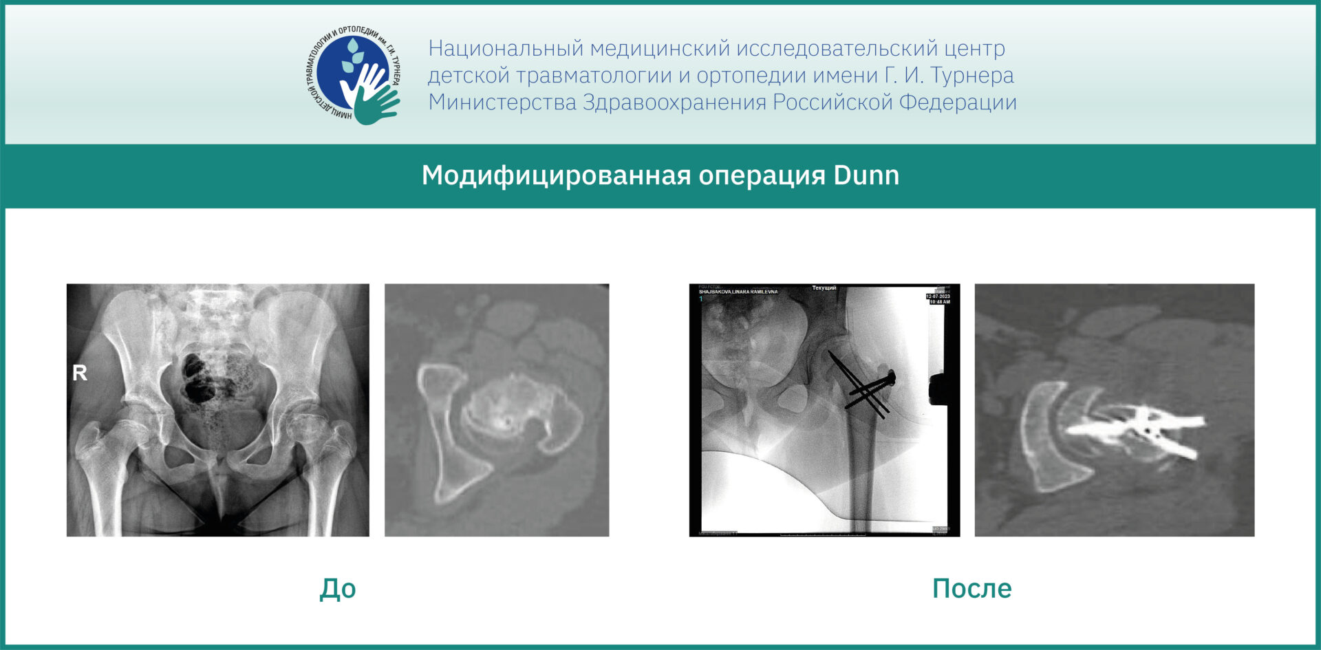Консультативная и хирургическая помощь в Чебоксарах в рамках рабочего визита Павла Бортулёва