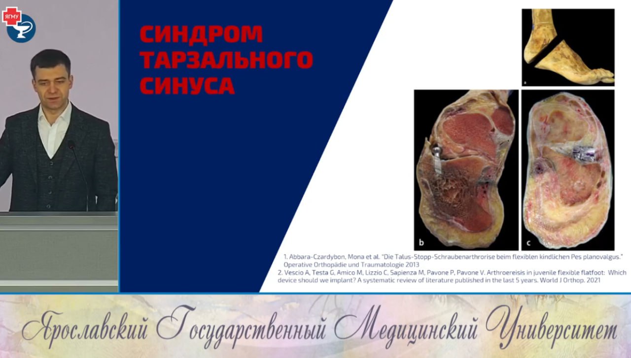 На передовой детской ортопедии: специалисты НМИЦ им. Г. И. Турнера на конференции «Ярославская весна 2025»